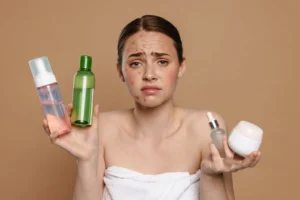 Wat te doen bij acne?
